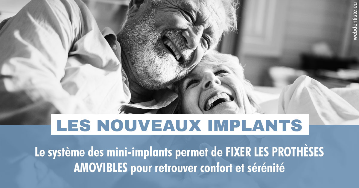https://dr-bourdin-david.chirurgiens-dentistes.fr/Les nouveaux implants 2