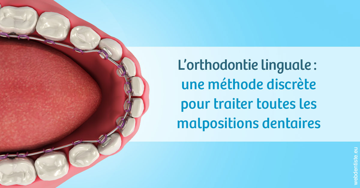https://dr-bourdin-david.chirurgiens-dentistes.fr/L'orthodontie linguale 1
