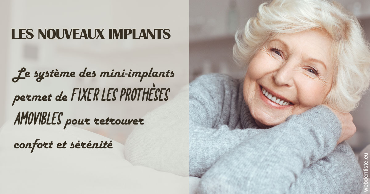 https://dr-bourdin-david.chirurgiens-dentistes.fr/Les nouveaux implants 1