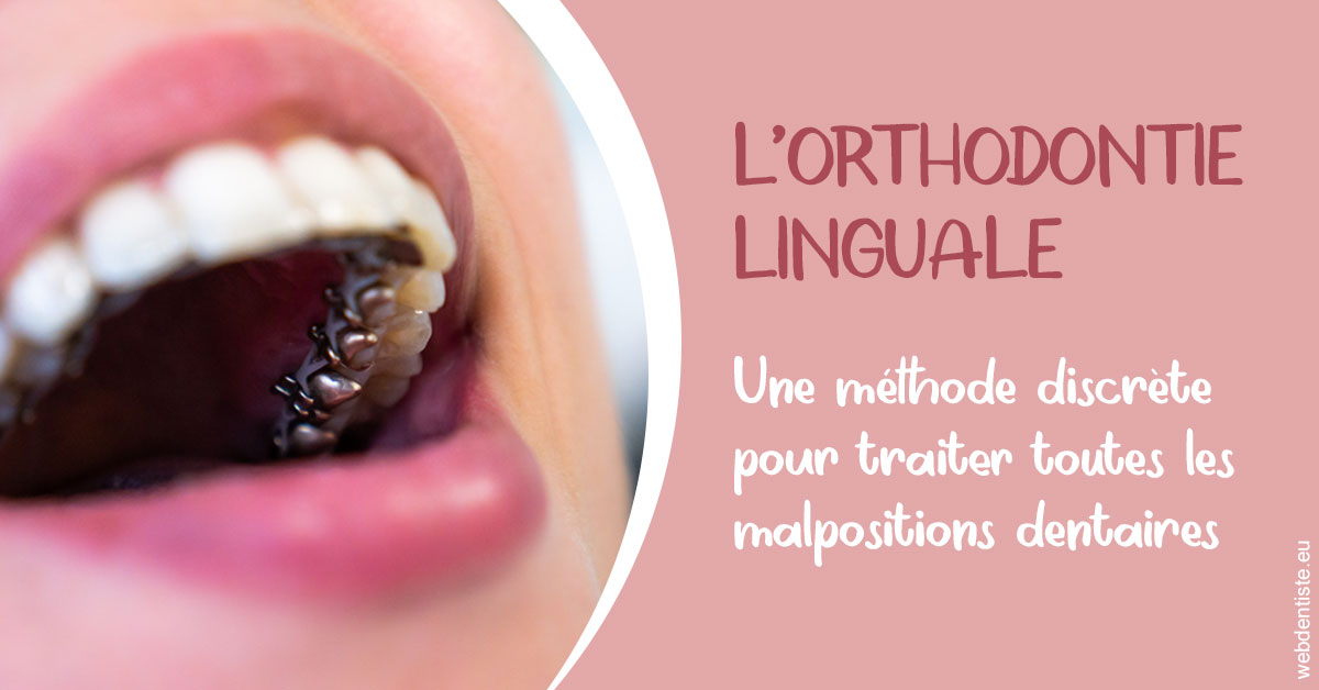 https://dr-bourdin-david.chirurgiens-dentistes.fr/L'orthodontie linguale 2