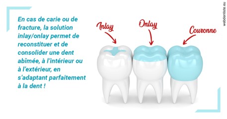 https://dr-bourdin-david.chirurgiens-dentistes.fr/L'INLAY ou l'ONLAY
