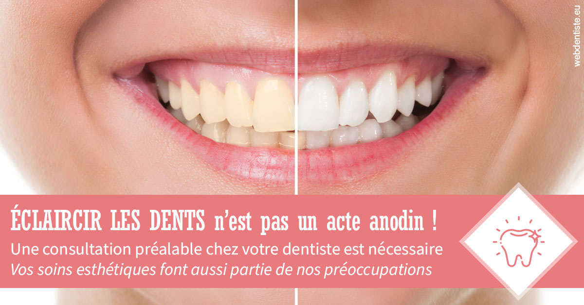https://dr-bourdin-david.chirurgiens-dentistes.fr/Eclaircir les dents 1