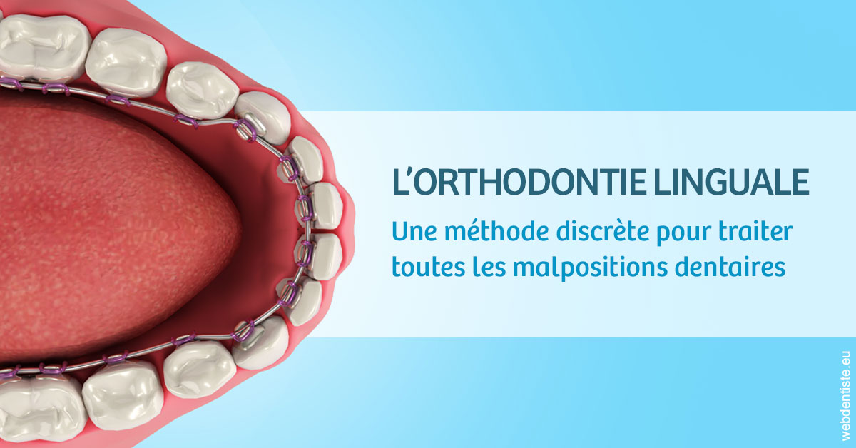 https://dr-bourdin-david.chirurgiens-dentistes.fr/L'orthodontie linguale 1