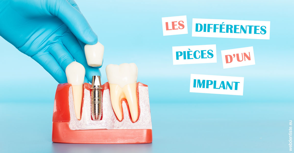 https://dr-bourdin-david.chirurgiens-dentistes.fr/Les différentes pièces d’un implant 2