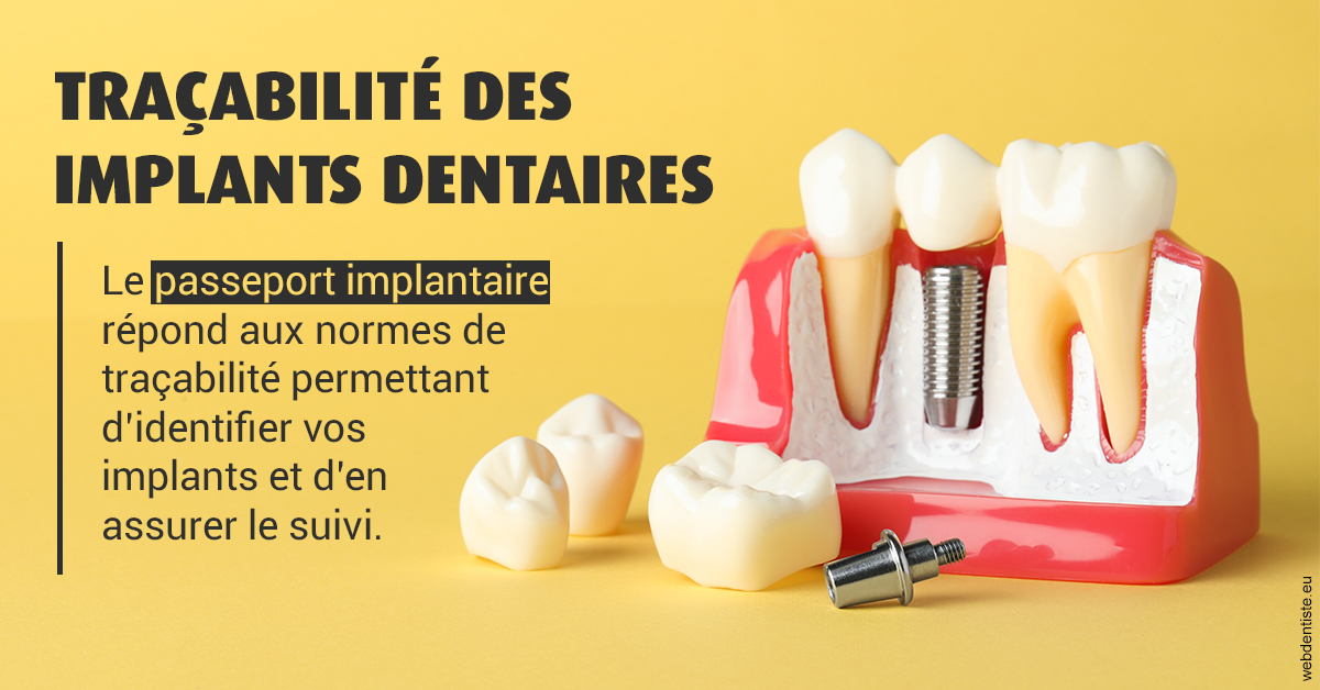 https://dr-bourdin-david.chirurgiens-dentistes.fr/T2 2023 - Traçabilité des implants 2