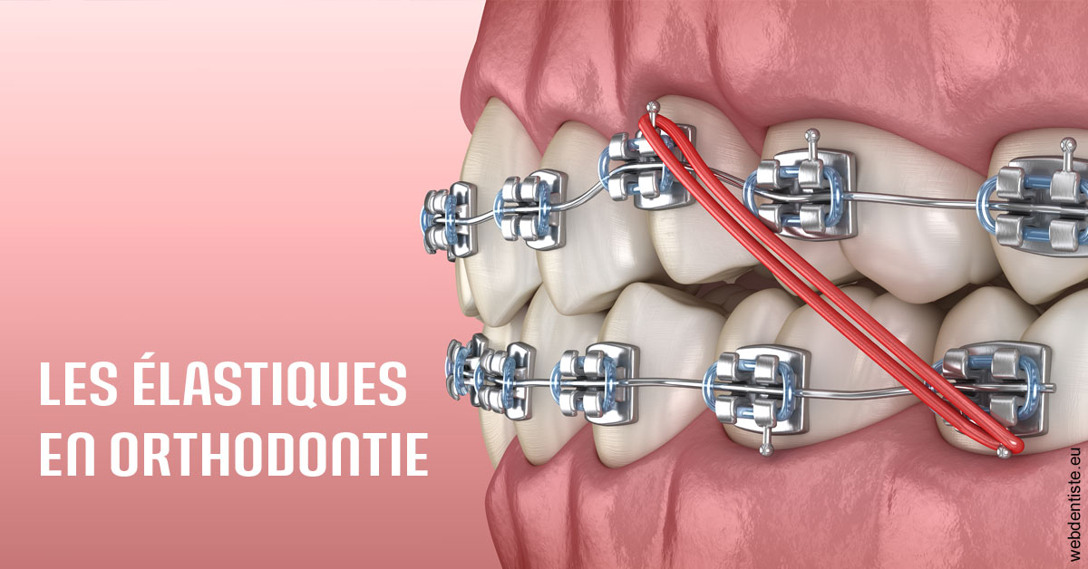 https://dr-bourdin-david.chirurgiens-dentistes.fr/Elastiques orthodontie 2