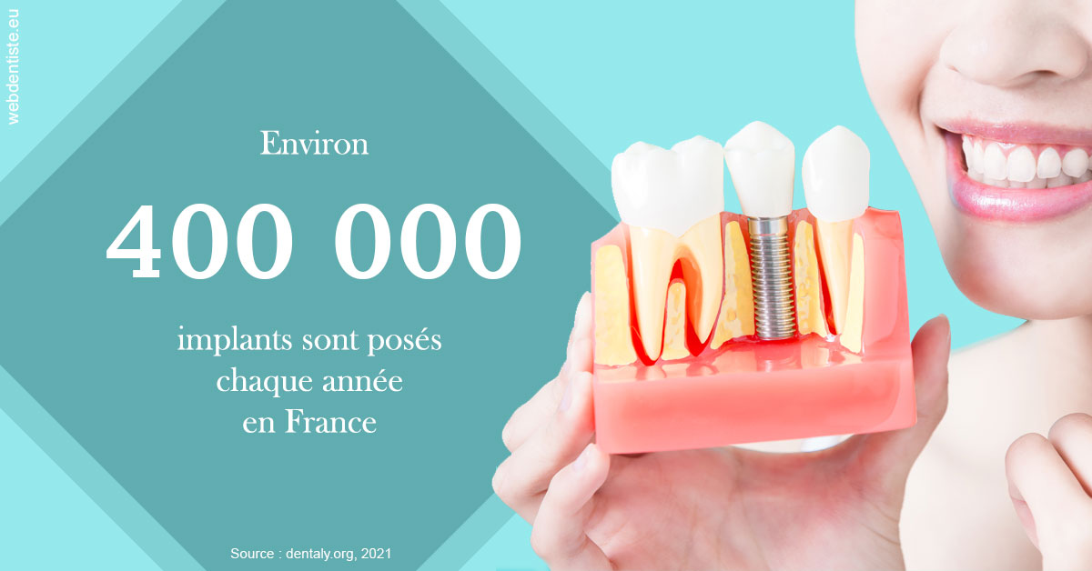 https://dr-bourdin-david.chirurgiens-dentistes.fr/Pose d'implants en France 2