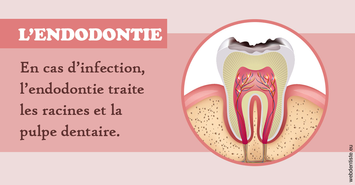https://dr-bourdin-david.chirurgiens-dentistes.fr/L'endodontie 2