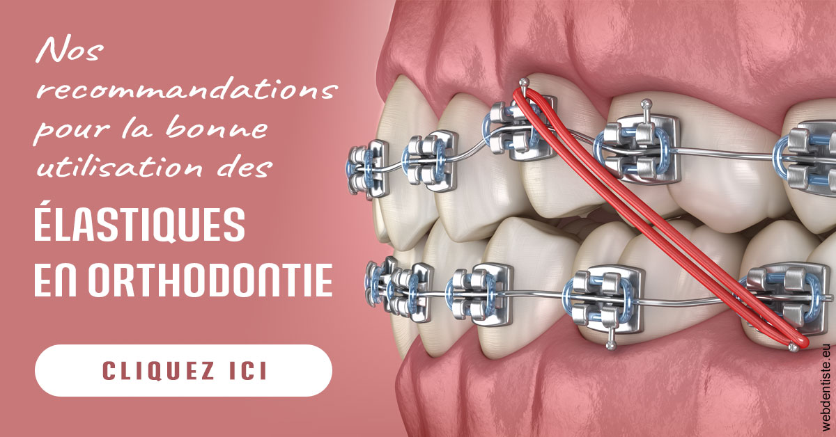 https://dr-bourdin-david.chirurgiens-dentistes.fr/Elastiques orthodontie 2
